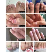 LANBENA Nail Repair Essence Serum - Image 4